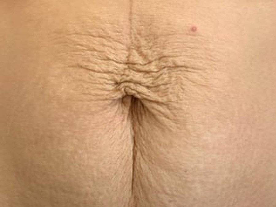 RF по телу на Новый Body Shape